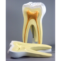 Модель "Строение зуба" - «globural.ru» - Мурманск