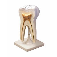 Модель строения зуба - «globural.ru» - Мурманск