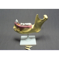 Модель "Челюсть разборная" - «globural.ru» - Мурманск