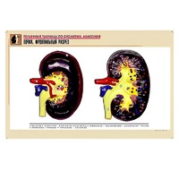 Рельефная таблица "Почка. Фронтальный разрез" (формат А1, матовое ламинир.) - «globural.ru» - Мурманск